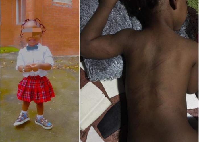 2-year-old left with bruises after she was allegedly flogged mercilessly by her teacher for failing to recite the alphabets (photos)