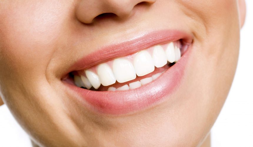 Dentists warn Nigerians against patronising beauty salons for tooth whitening￼