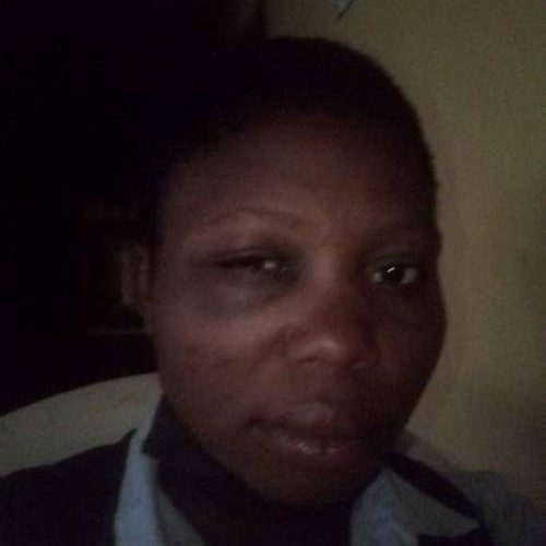 Woman Laments After Officers Brutalise Her For Entering Police Barracks In Kaduna