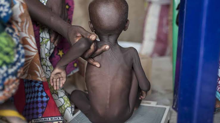 “420,000 Nigerian children could di£ this year due to severe acute malnutrition” UNICEF warns