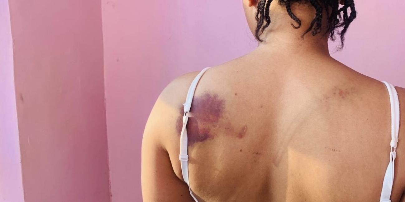 Nigerian Policemen In Delta Command Brutalise, Detain Woman For Days Over Alleged Possession Of Condom