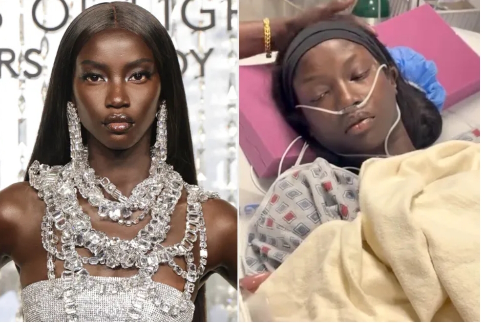 Supermodel Anok Yai reveals Congneital Lung Defect diagosis as she undergoes robotic surgery