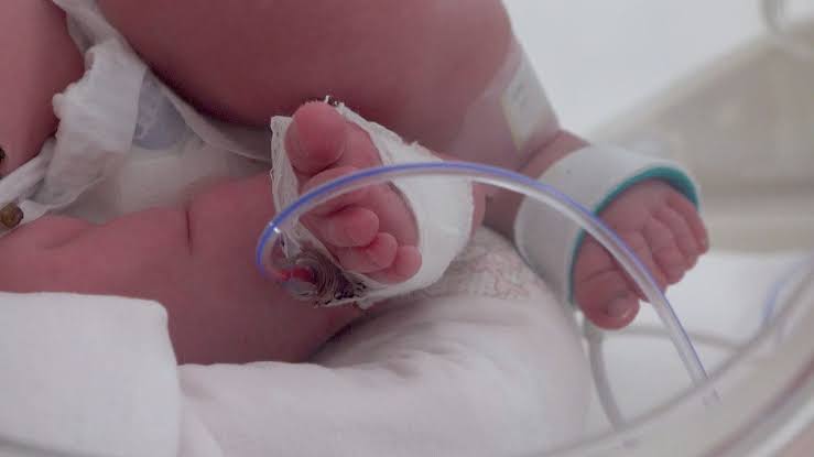 2 million premature births and about 74,000 newborn deaths linked to plastic chemical