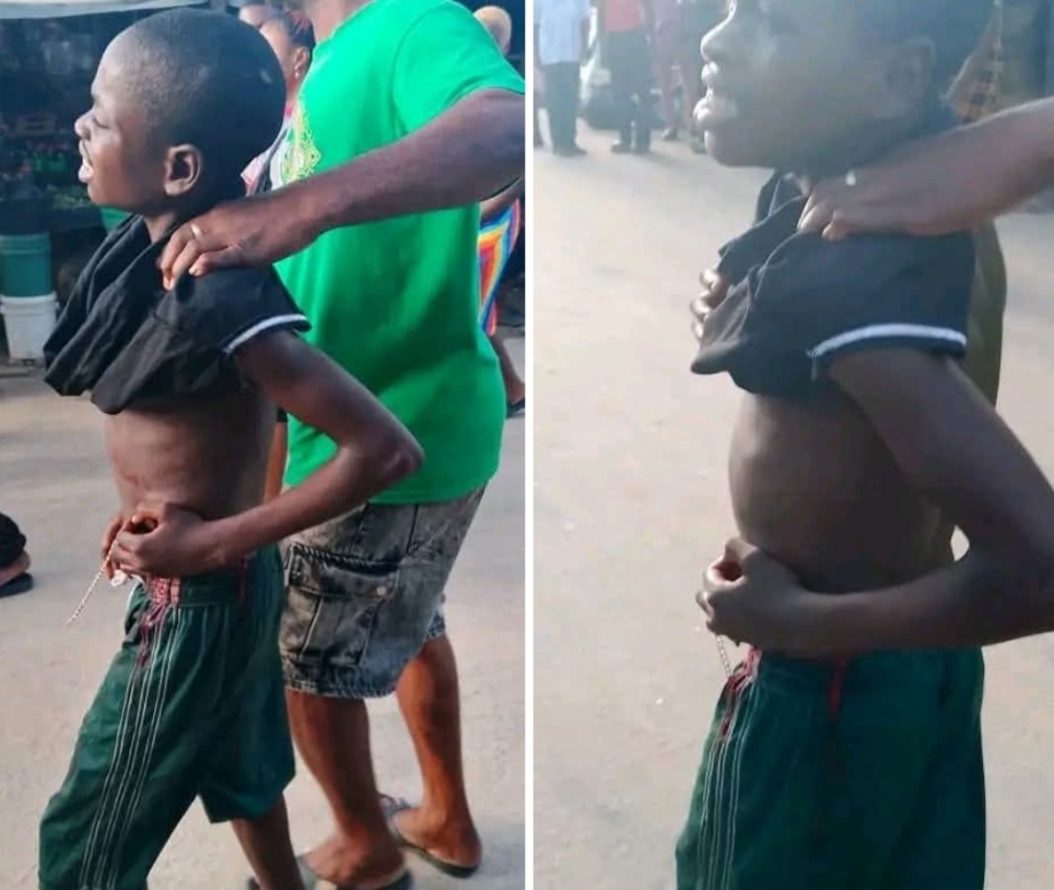 Stray bullet hits boy during NDLEA operations in Bakassi